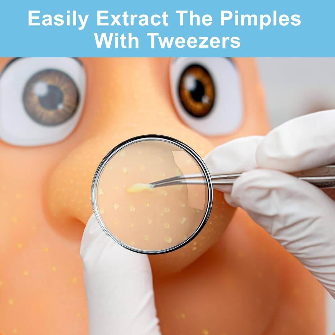 PIMPLE PADDY™